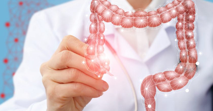 καρκίνος παχέος εντέρου